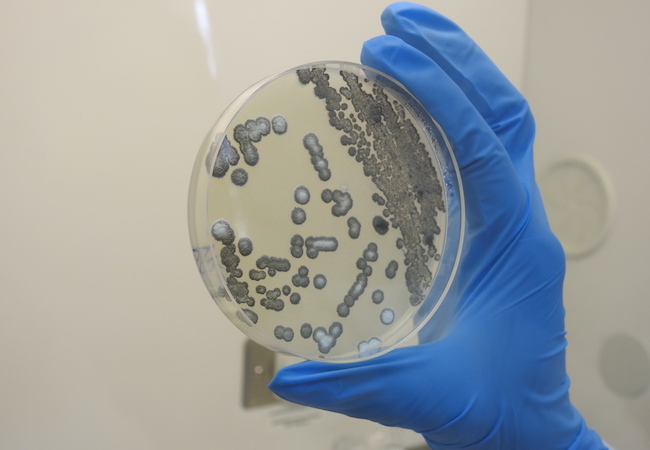 Unidad de Microbiología y Microbioma